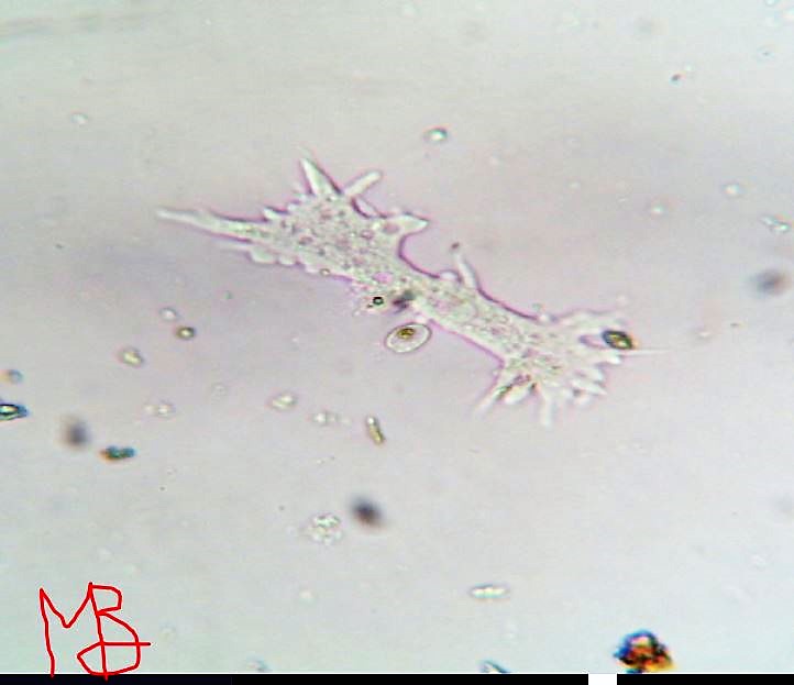 Amoeba stellata metamorfosi